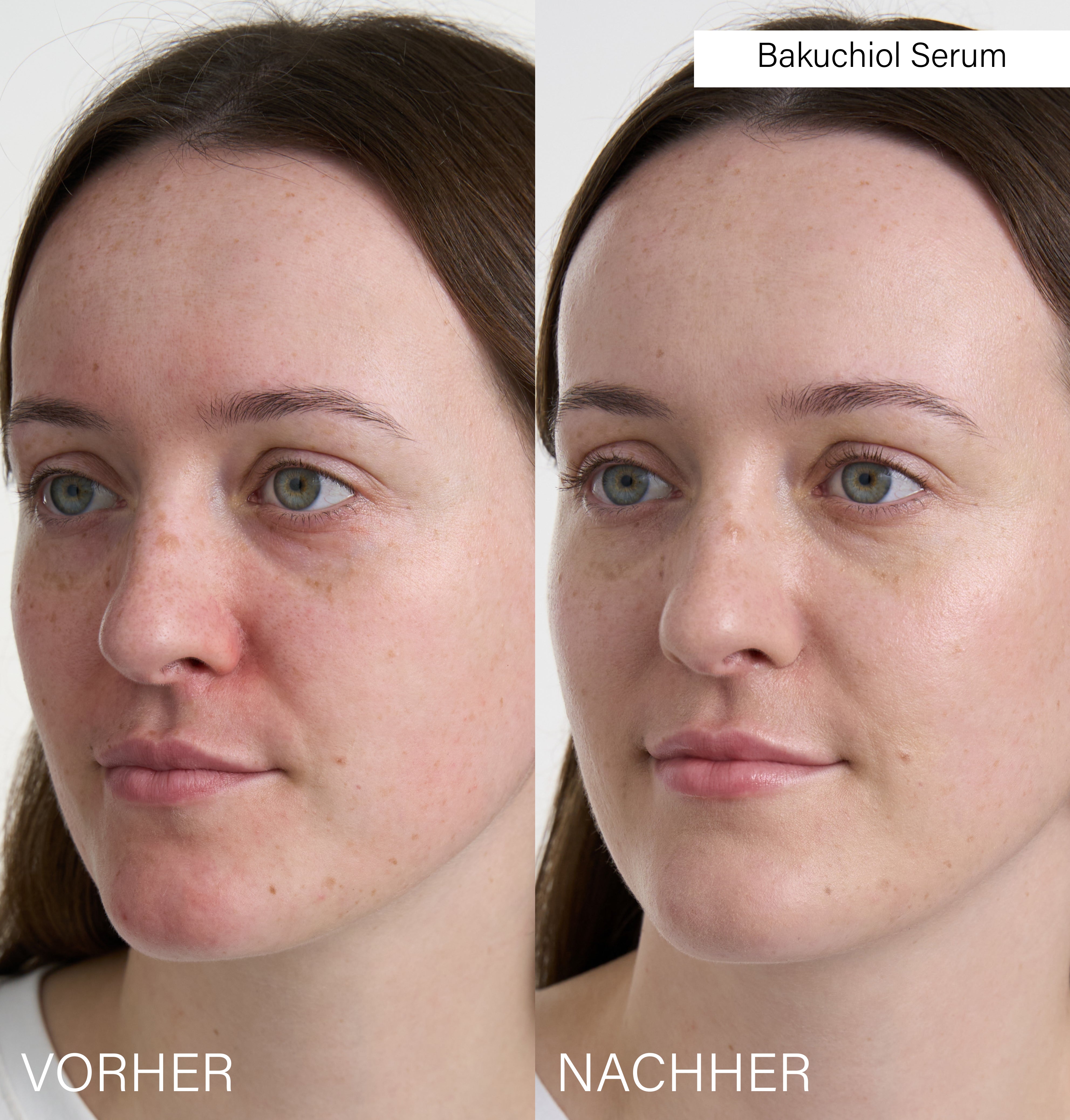 Bakuchiol Serum | Natural retinol alternative