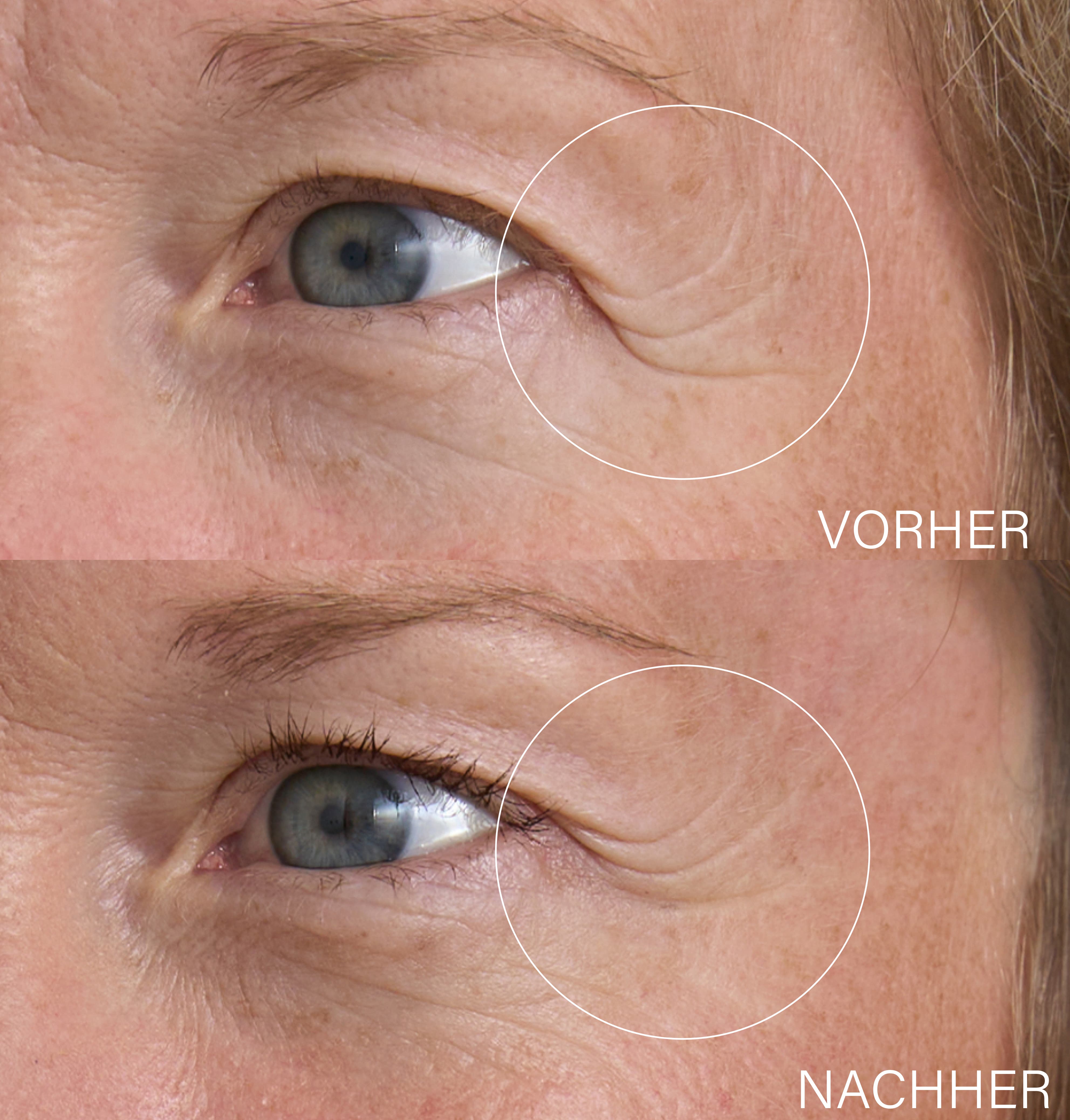 Day & Night Eye Balm Set