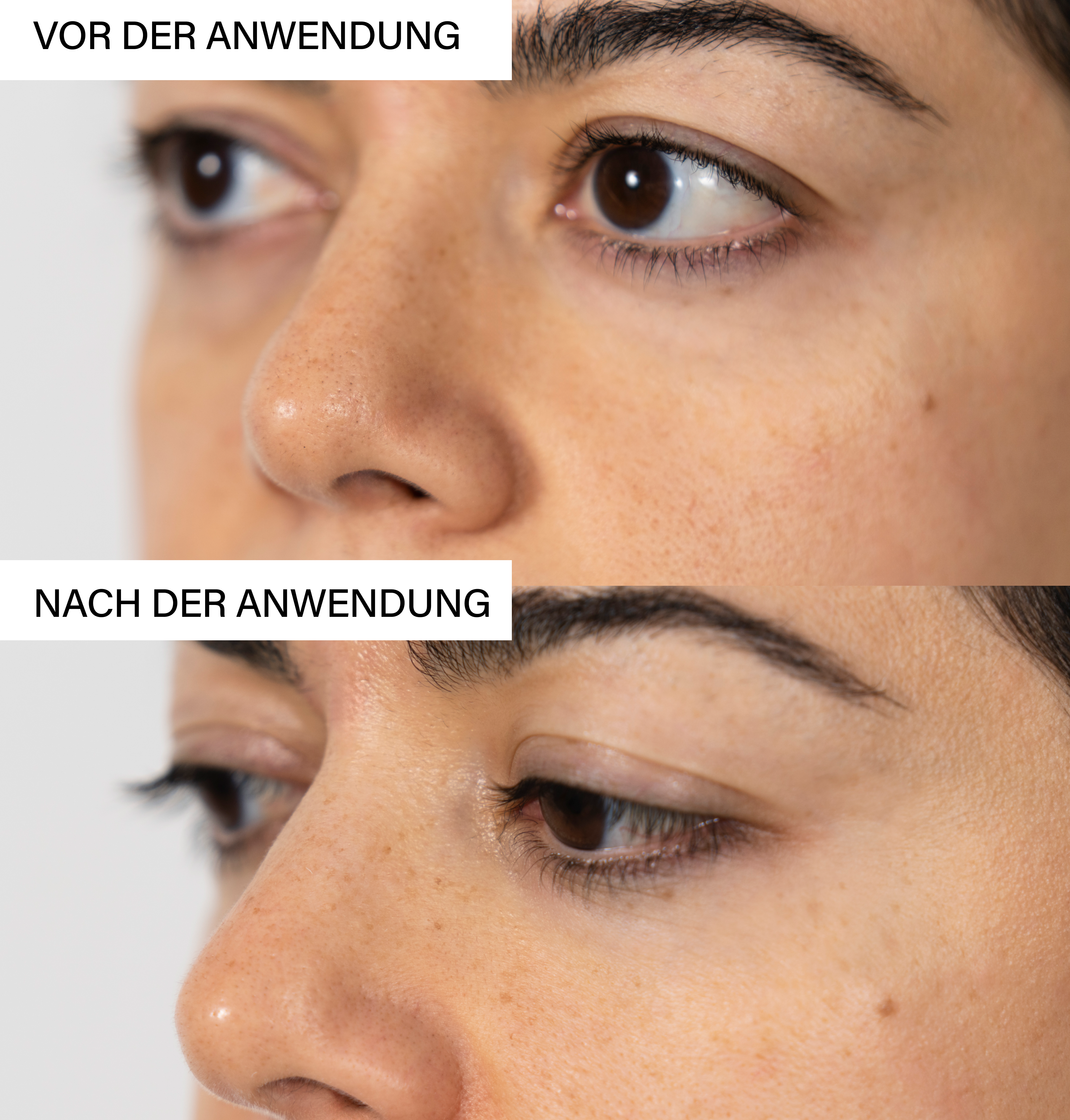 Skin Exfoliating Peeling