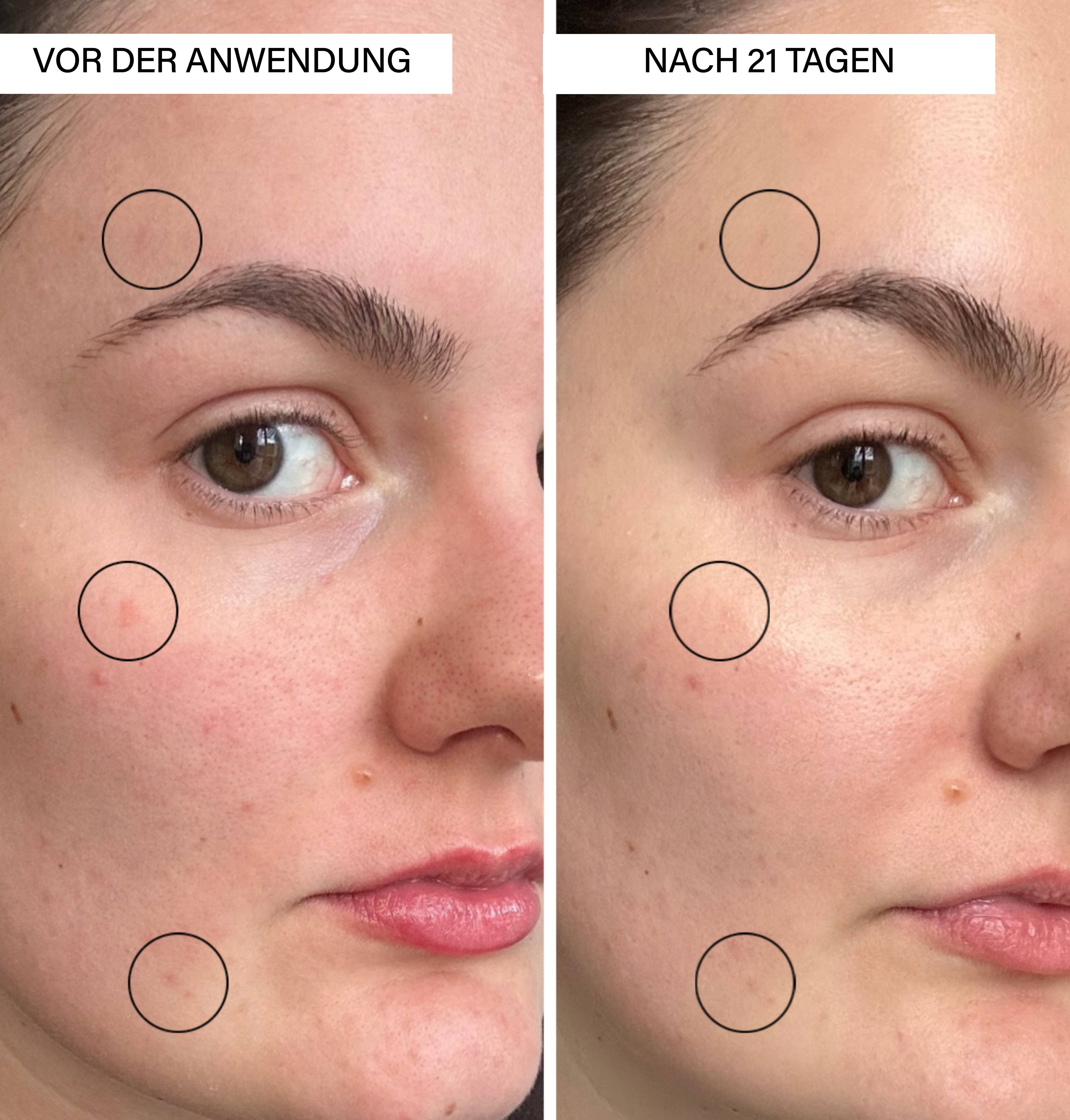 Anti-Hyperpigmentation Set