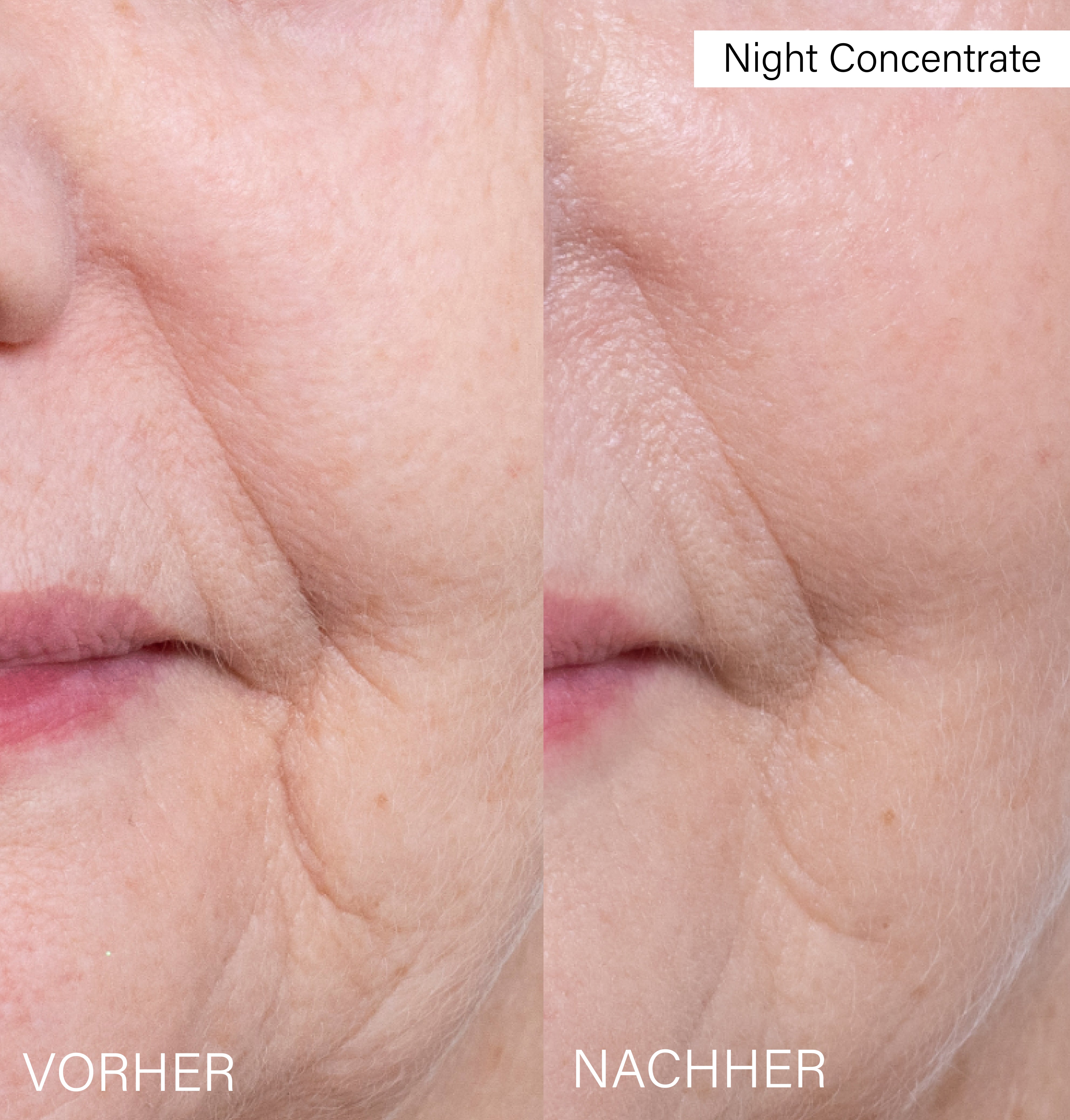 Microneedling Night Duo