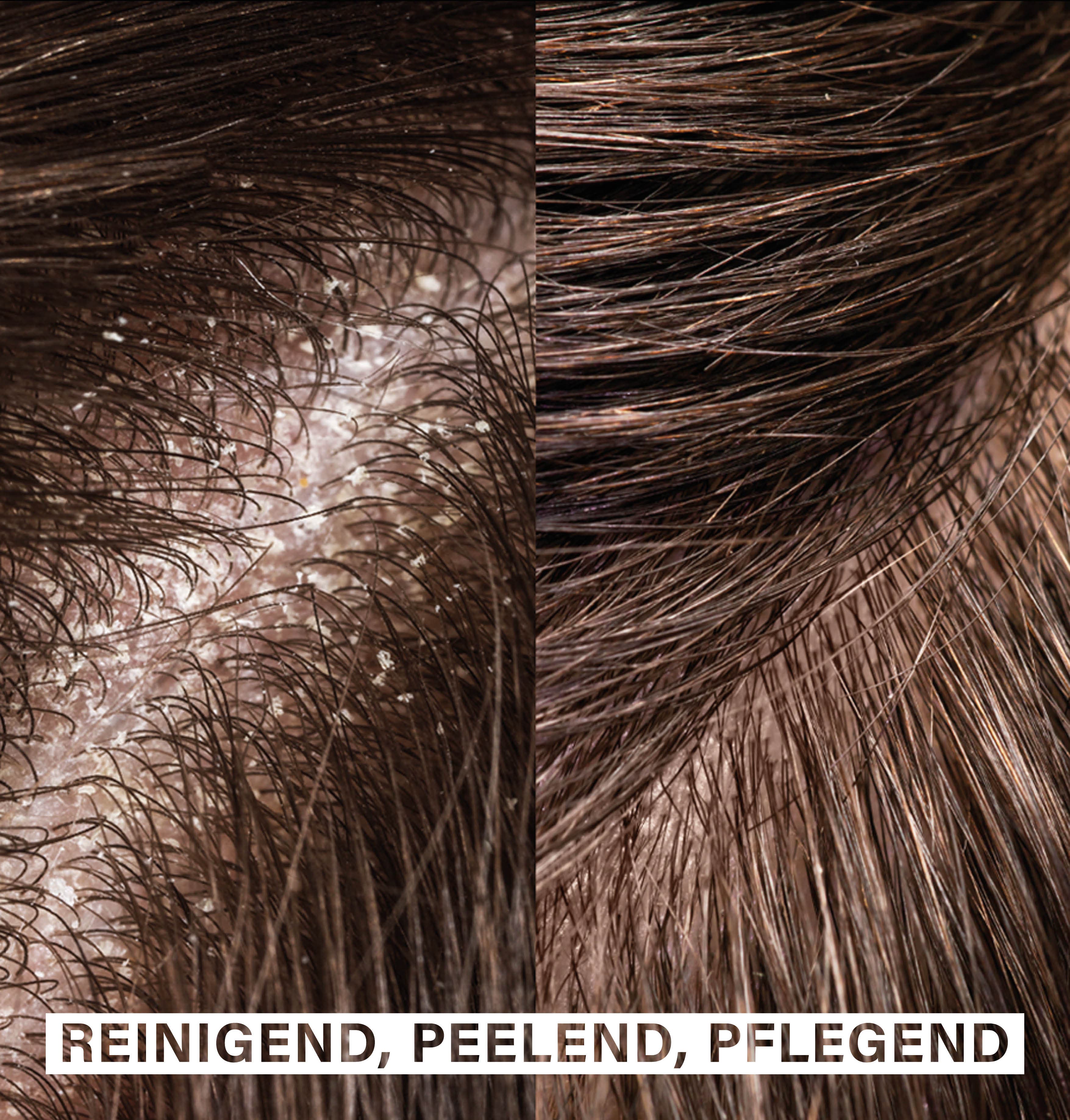 Scalp Exfoliating Shampoo