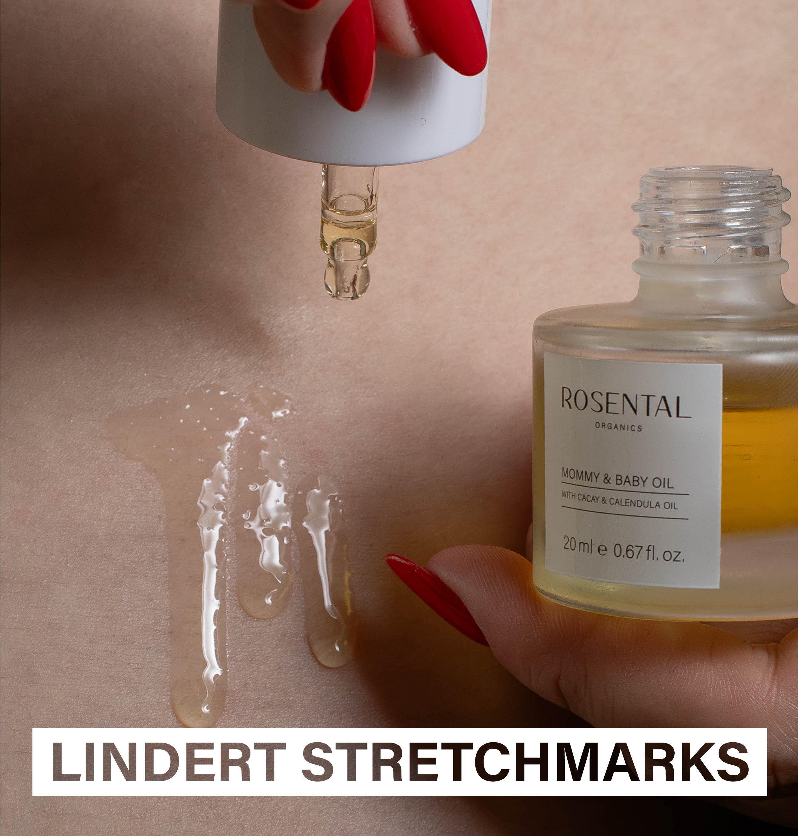 Regenerating Oil | For stretch marks & scars