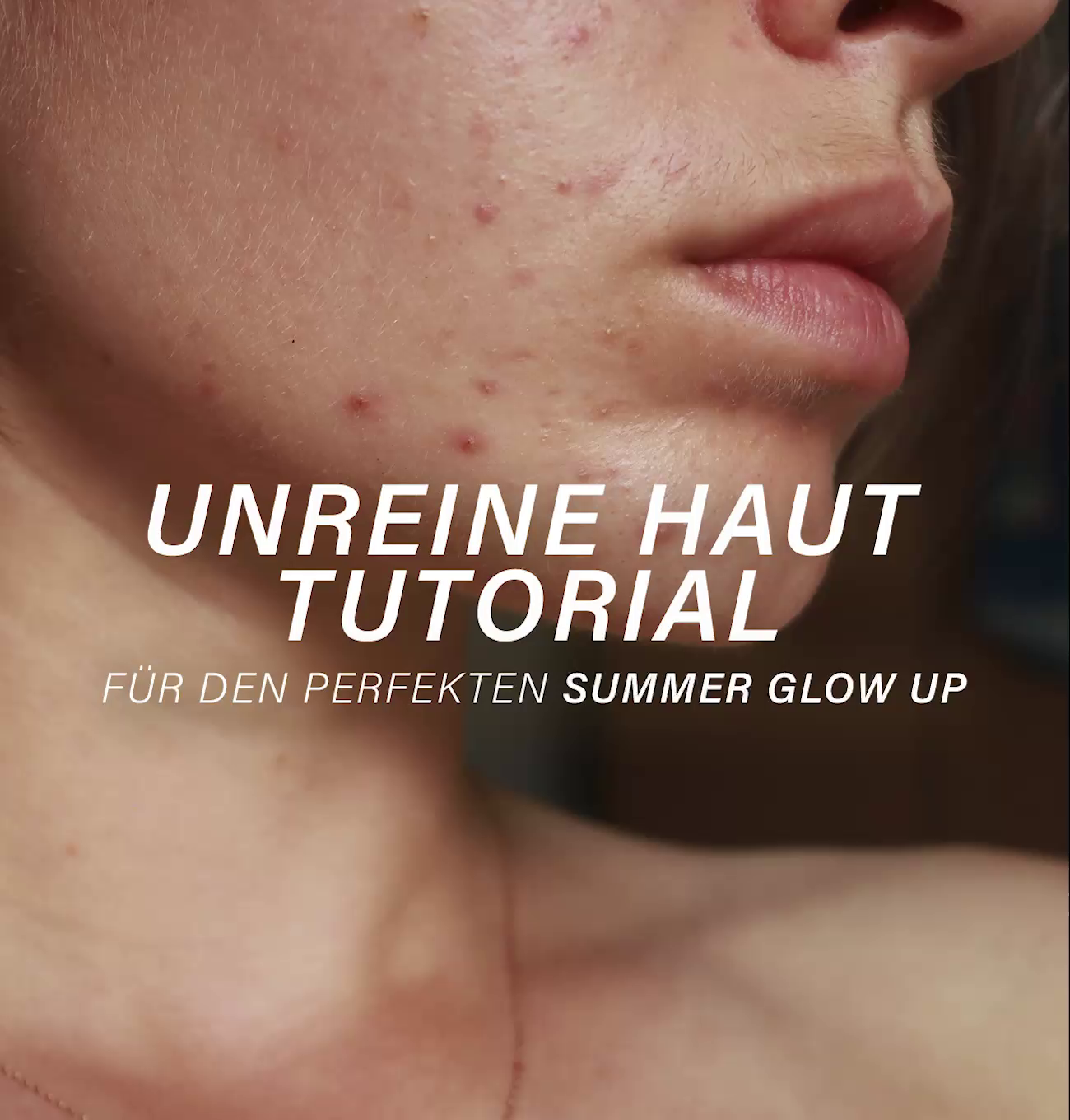 Free Summer Blemished Skin Tutorial
