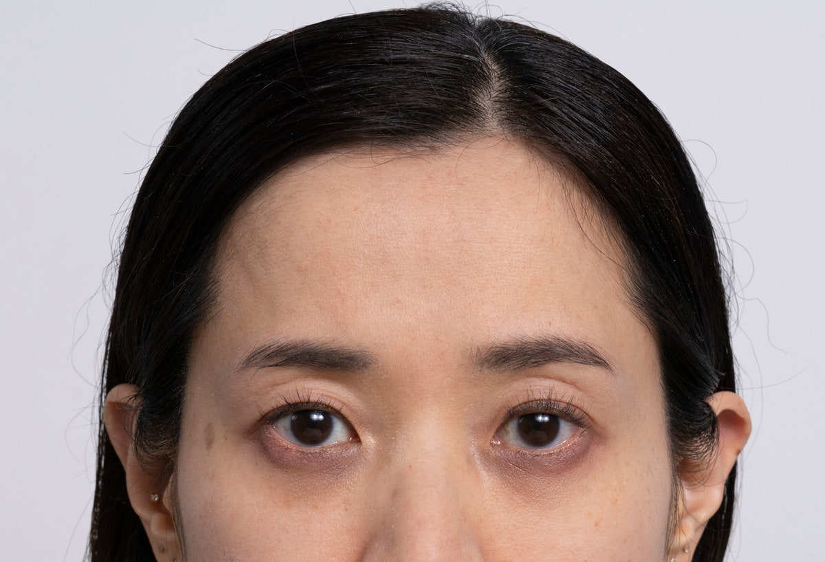 BB Eye Balm