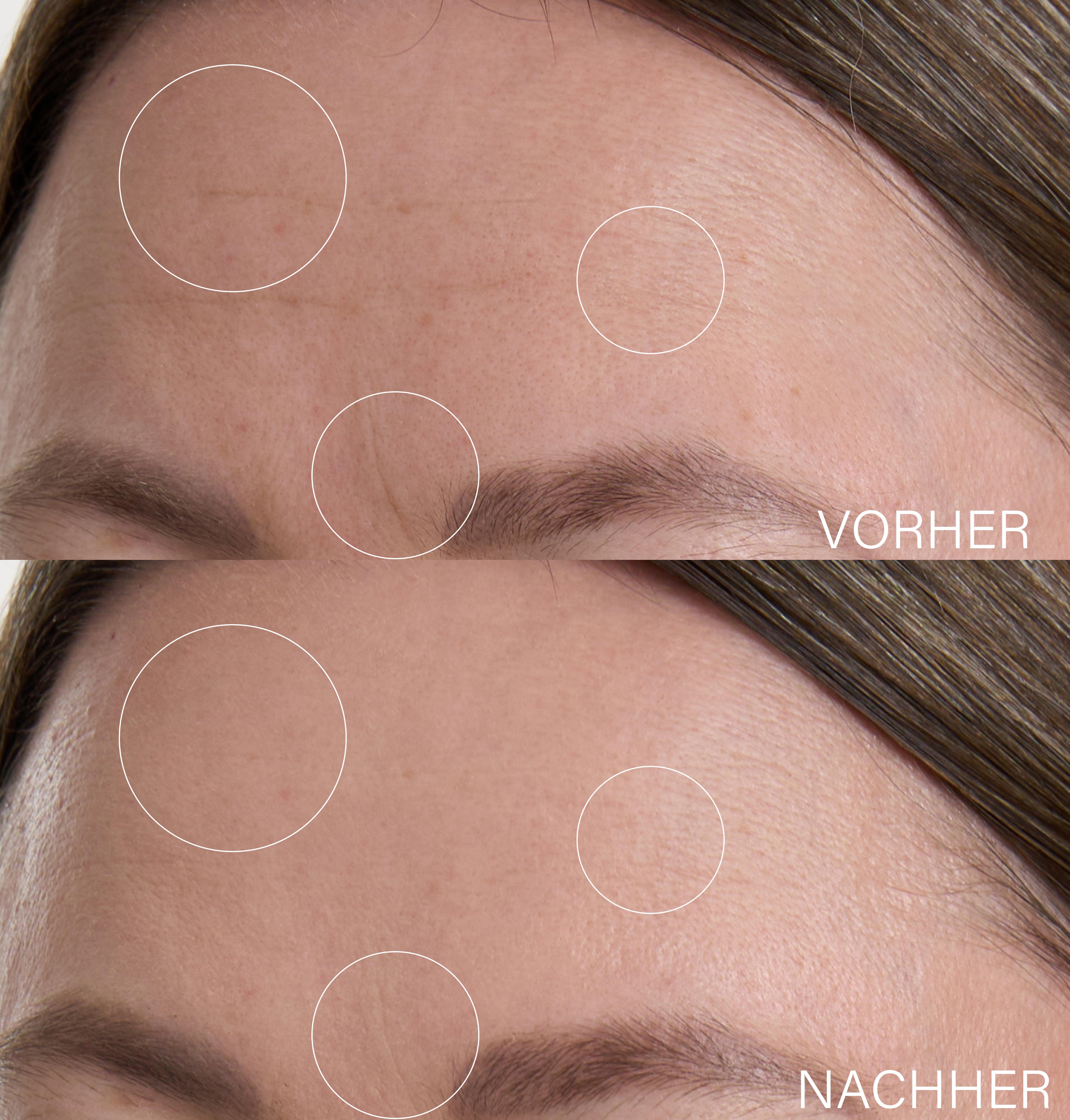 Botanical Lifting Effect Serum | with hyaluronic acid