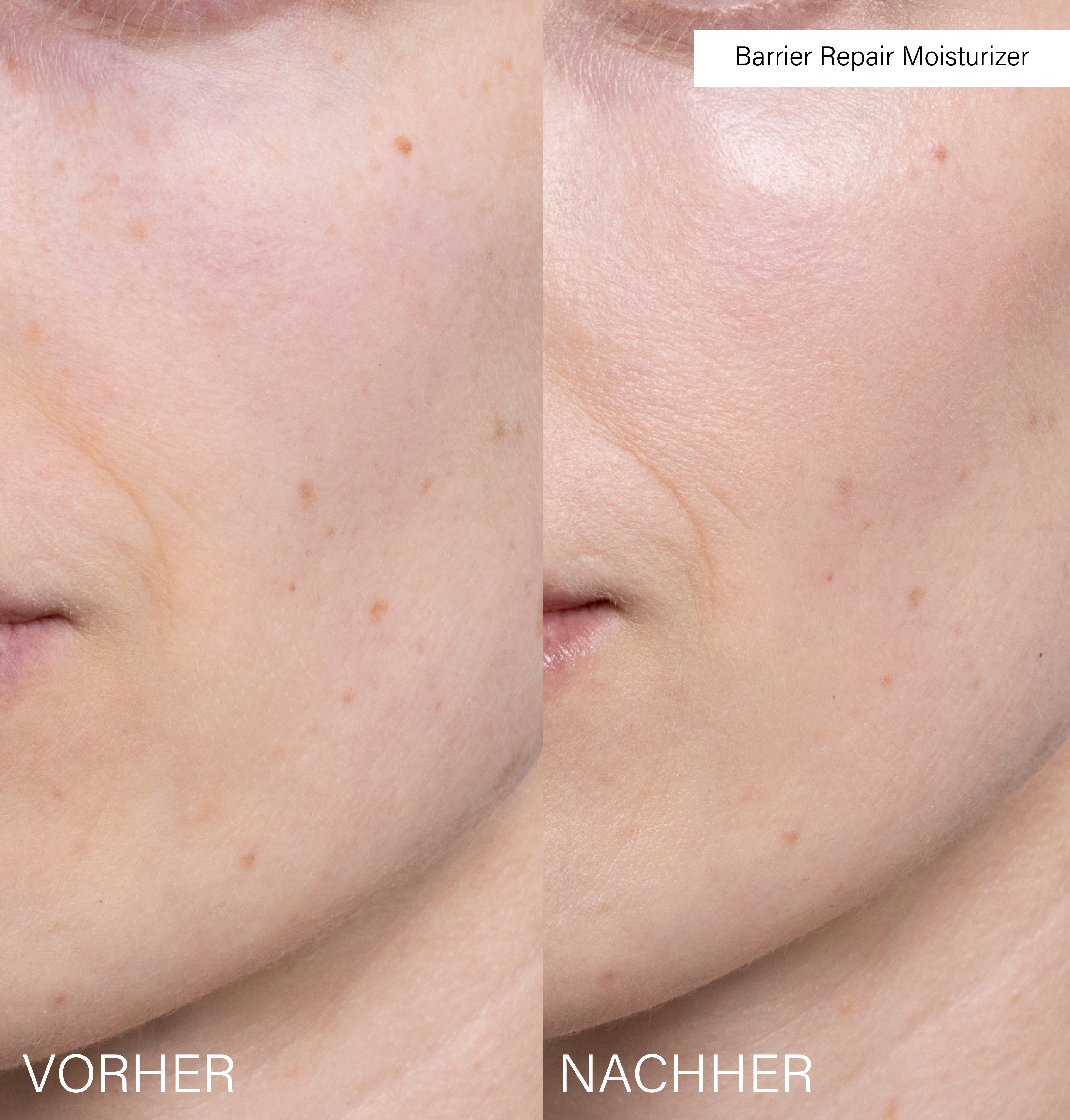 Barrier Repair Moisturizer | with probiotics