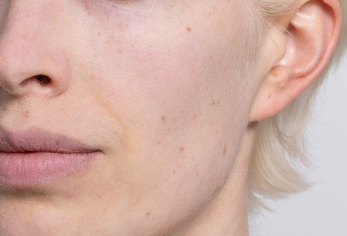 Barrier Repair Moisturizer
