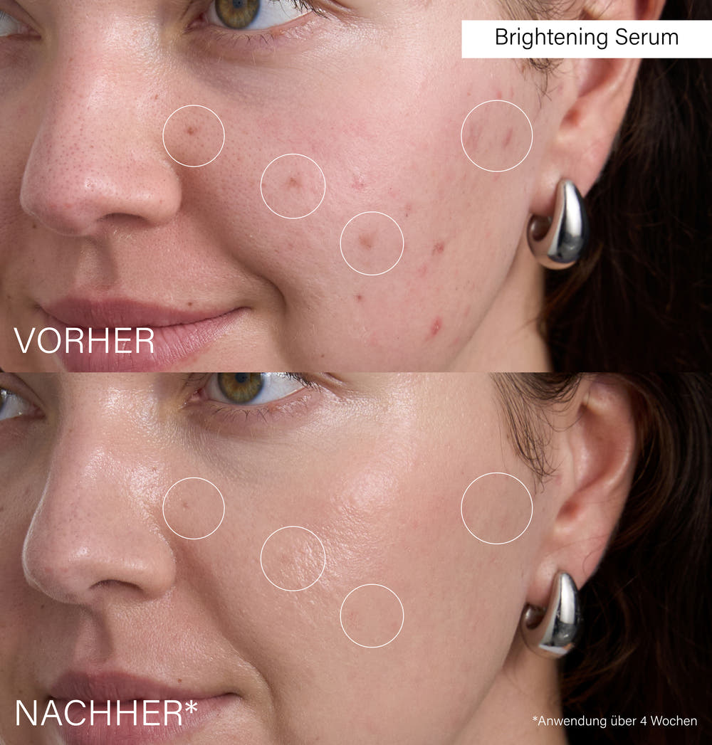 Brightening Serum | with Vitamin C &amp; Botanics