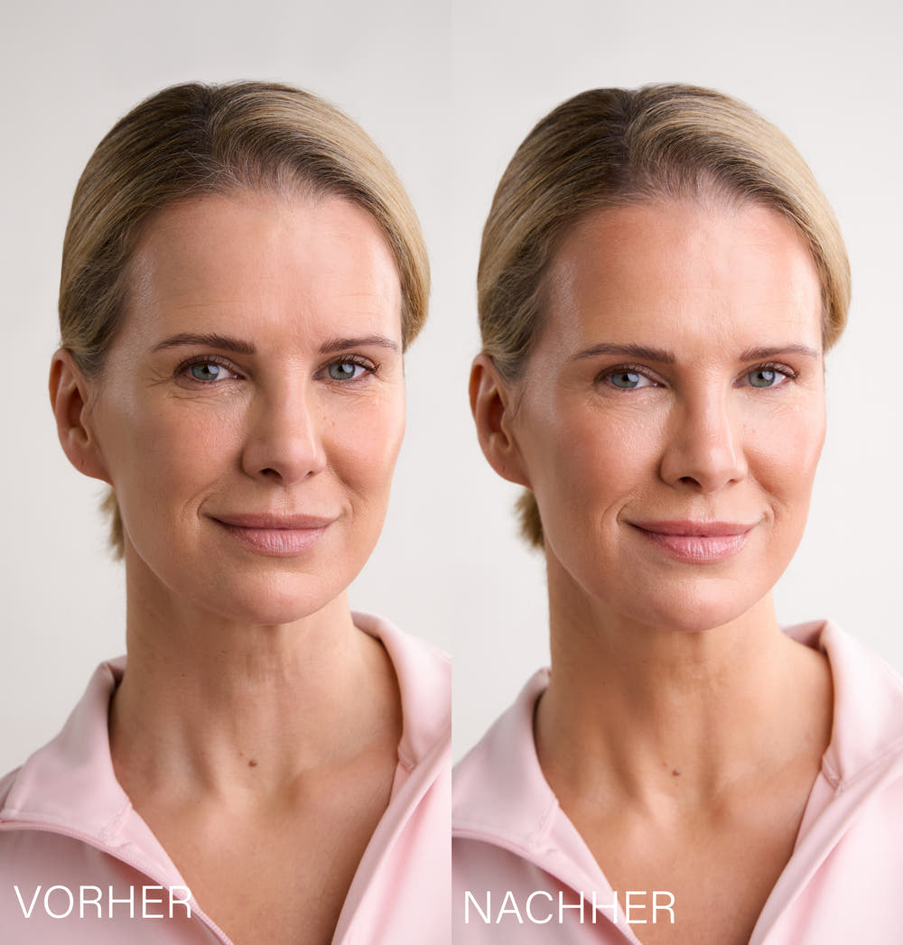 Lift & Calm Cupping Set | by Monica Ivancan